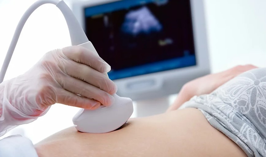 ECO DOPPLER VASCULAR