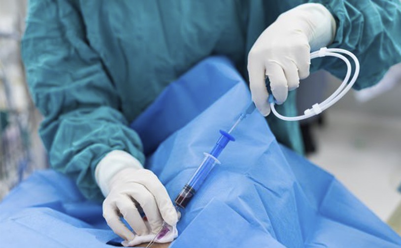 cirurgia endovascular