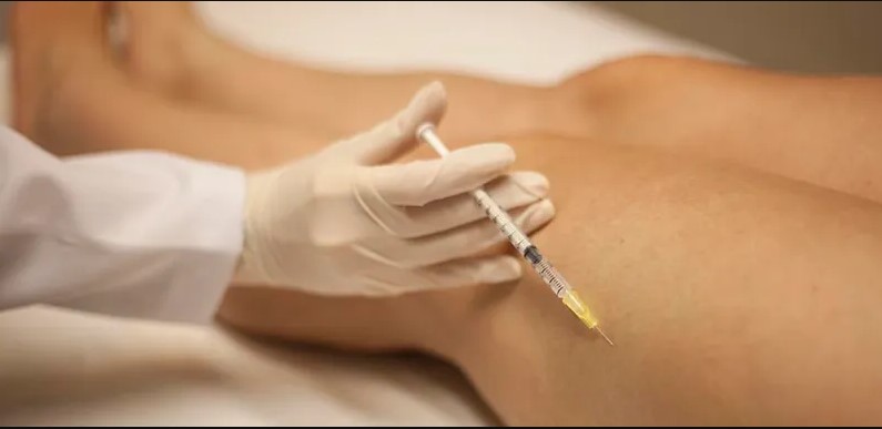 escleroterapia