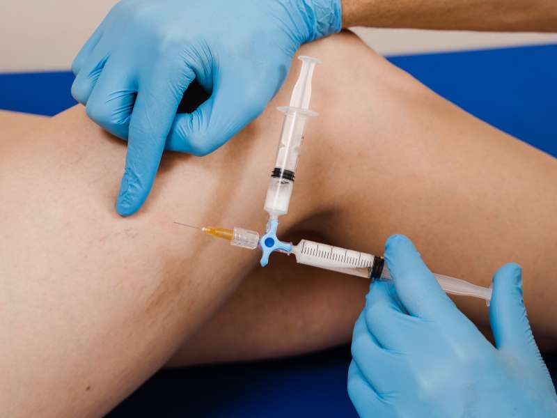 escleroterapia em uma perna