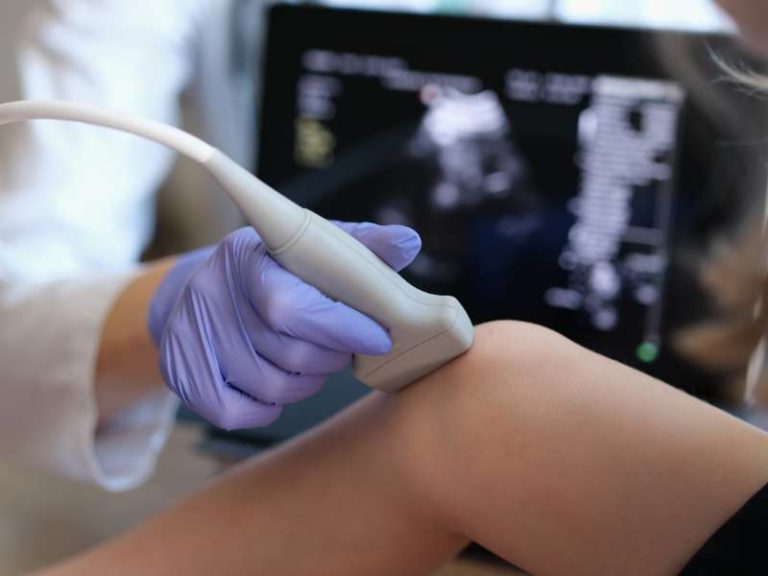 ultrassonografia doppler venoso nas pernas